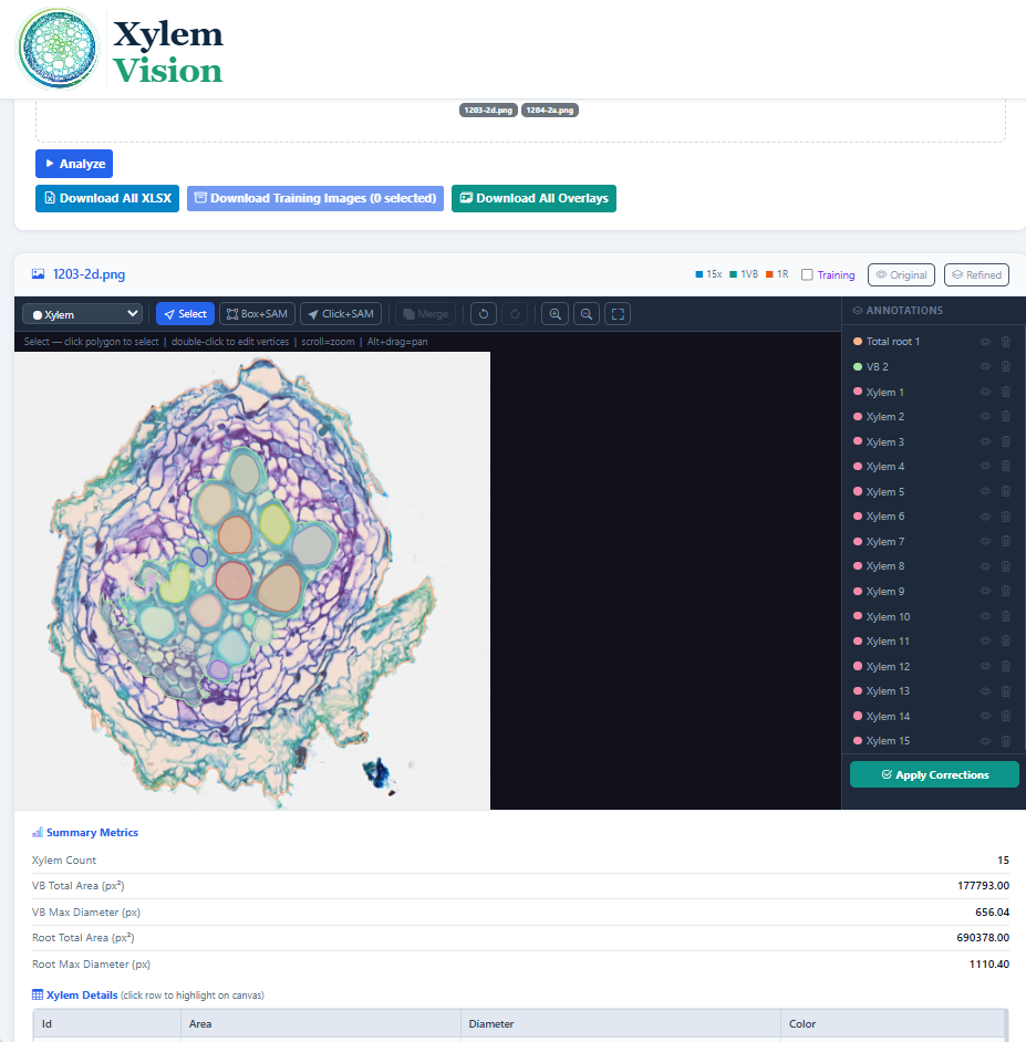 Xylem Vision